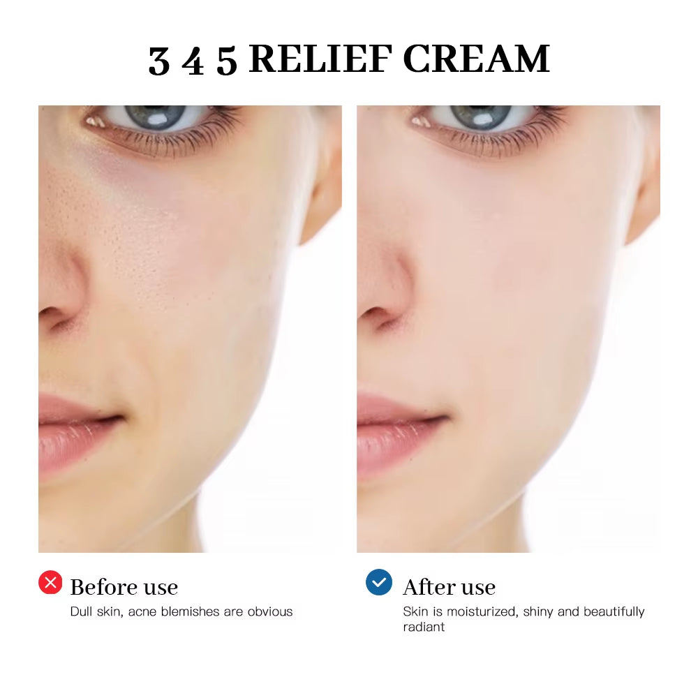 345 Relief Cream Address Blemishes Nourish the Skin and Provide Soothing Care Resulting in a Well-Rounded Skincare Solution